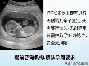 刚怀上能做亲子鉴定吗