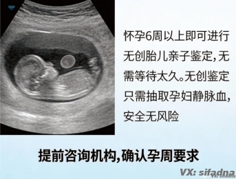 刚怀上能做亲子鉴定吗