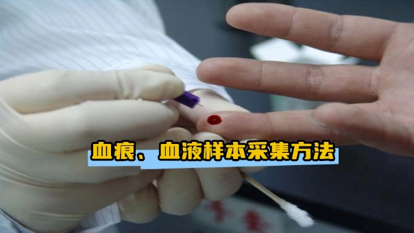 亲子鉴定:血痕、血液样本采集方法