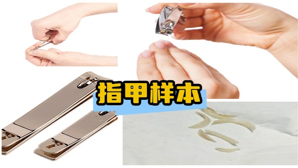 亲子鉴定：指甲样本采集方法和注意事项